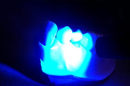 Exposing Low-Cost Dental Curing Lights